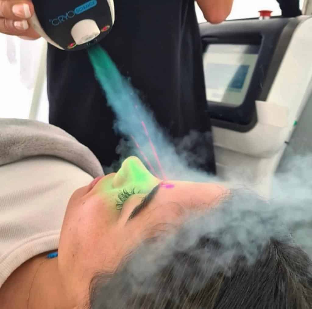 cryo facial adelaide